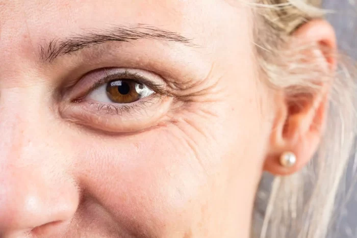 A close-up of a woman's face focusing on her right eye. The image highlights fine lines and wrinkles around the eye area. She has light skin, a pearl earring, and light-colored hair. Only part of her eyebrow and cheek are visible.