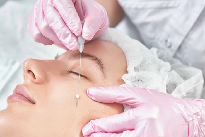 A person with their eyes closed is receiving a cosmetic procedure. Gloved hands are seen holding a needle and gently stretching the skin near the person's eye. The person wears a protective hair cap and appears relaxed.