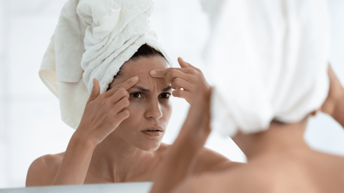 Woman concerned about lines on her forehead.