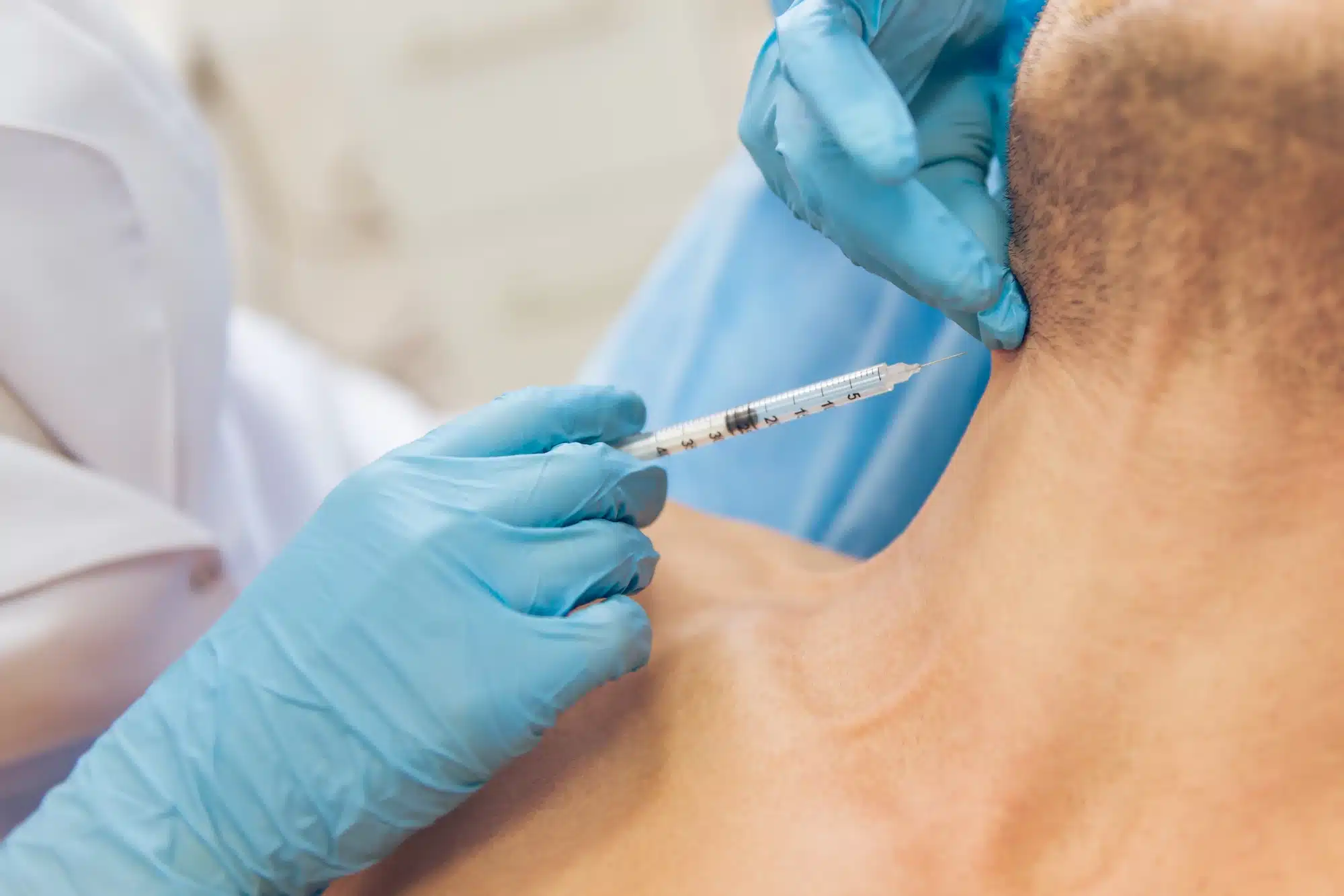 administering botox for myofascial trigger points in the neck