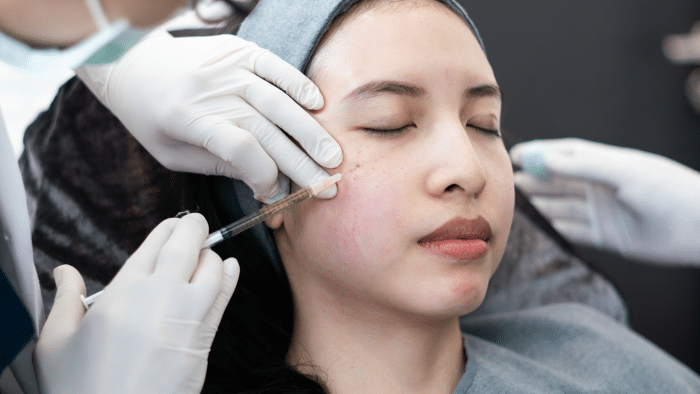 Injecting skin boosters.