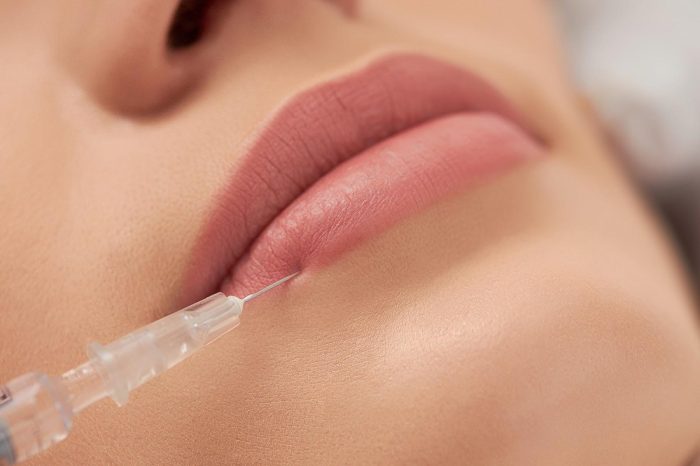 A patient receives lip injection using neuromodulator treatment.