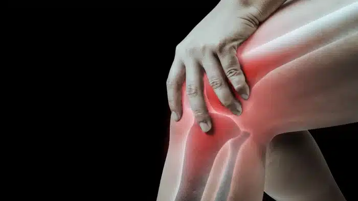 Knee treatment.
