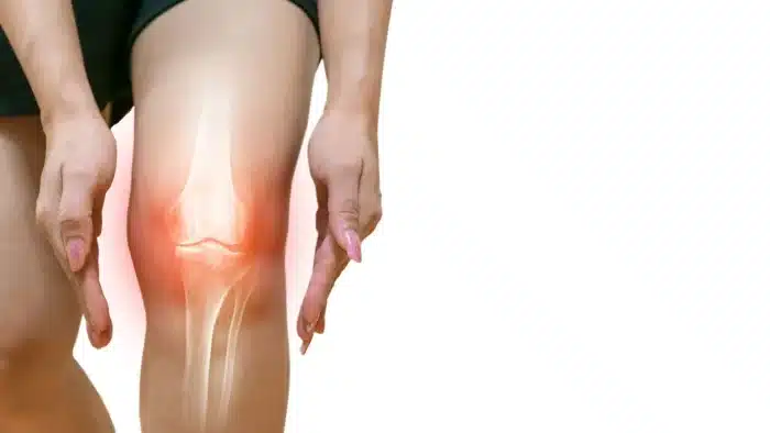 Knee treatment.