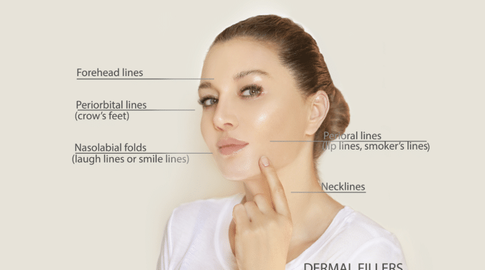 A woman with her hair in a bun touches her chin, highlighting various facial lines. Labels point to forehead lines, periorbital lines (crow’s feet), nasolabial folds (laugh lines or smile lines), perioral lines (lip lines, smoker's lines), and necklines.