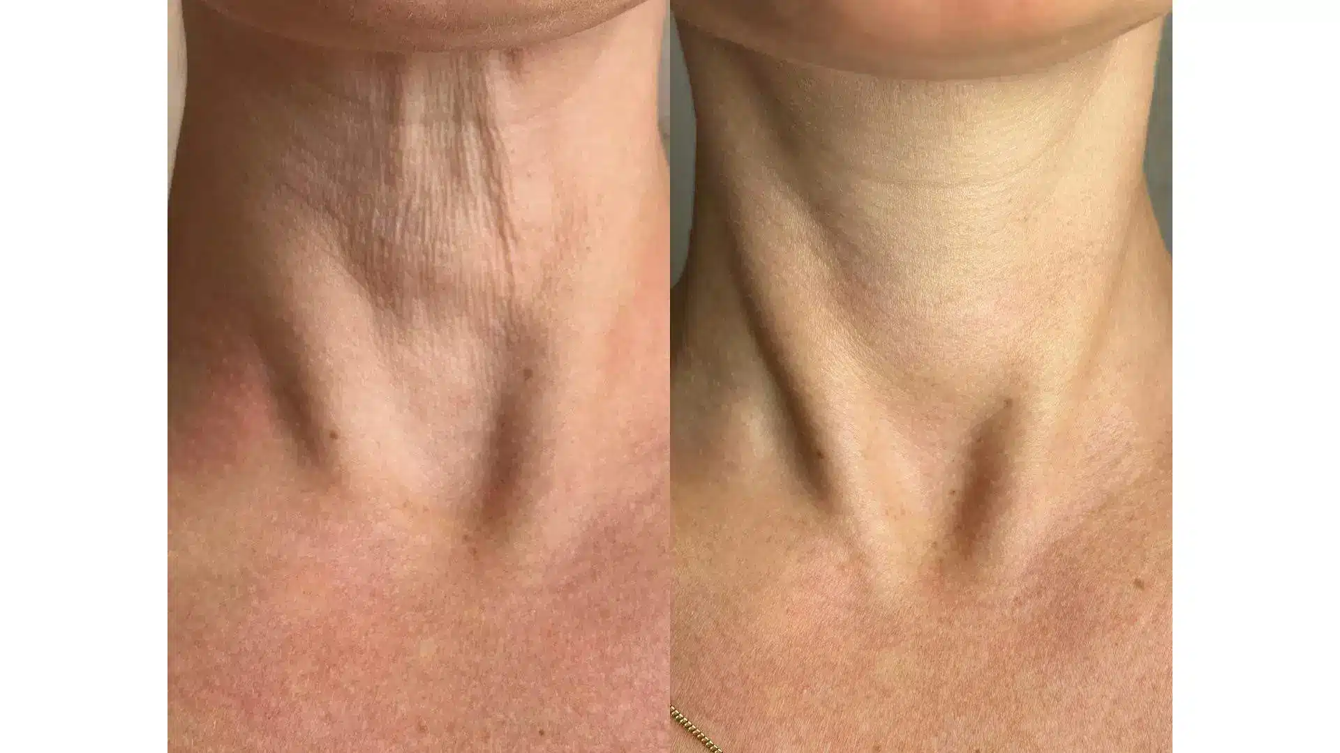 Before and After Images 2