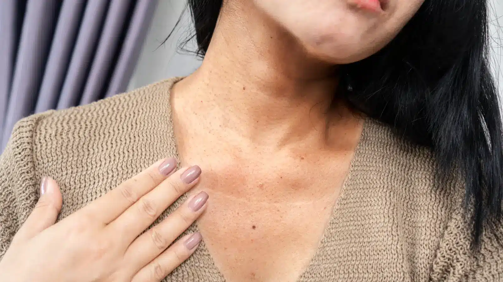 Woman getting neck injections. 