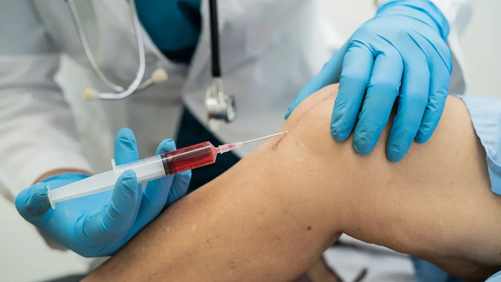 Knee injections.