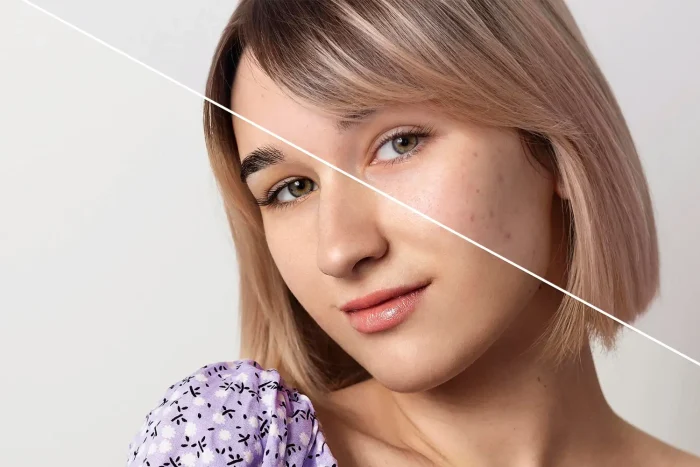 Before and after picture of a woman.
