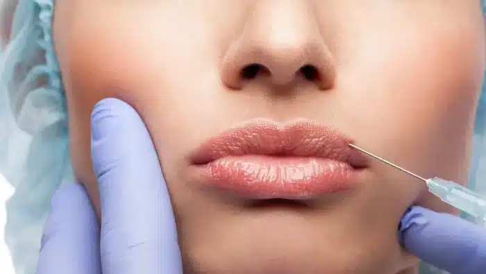 Facial injection.