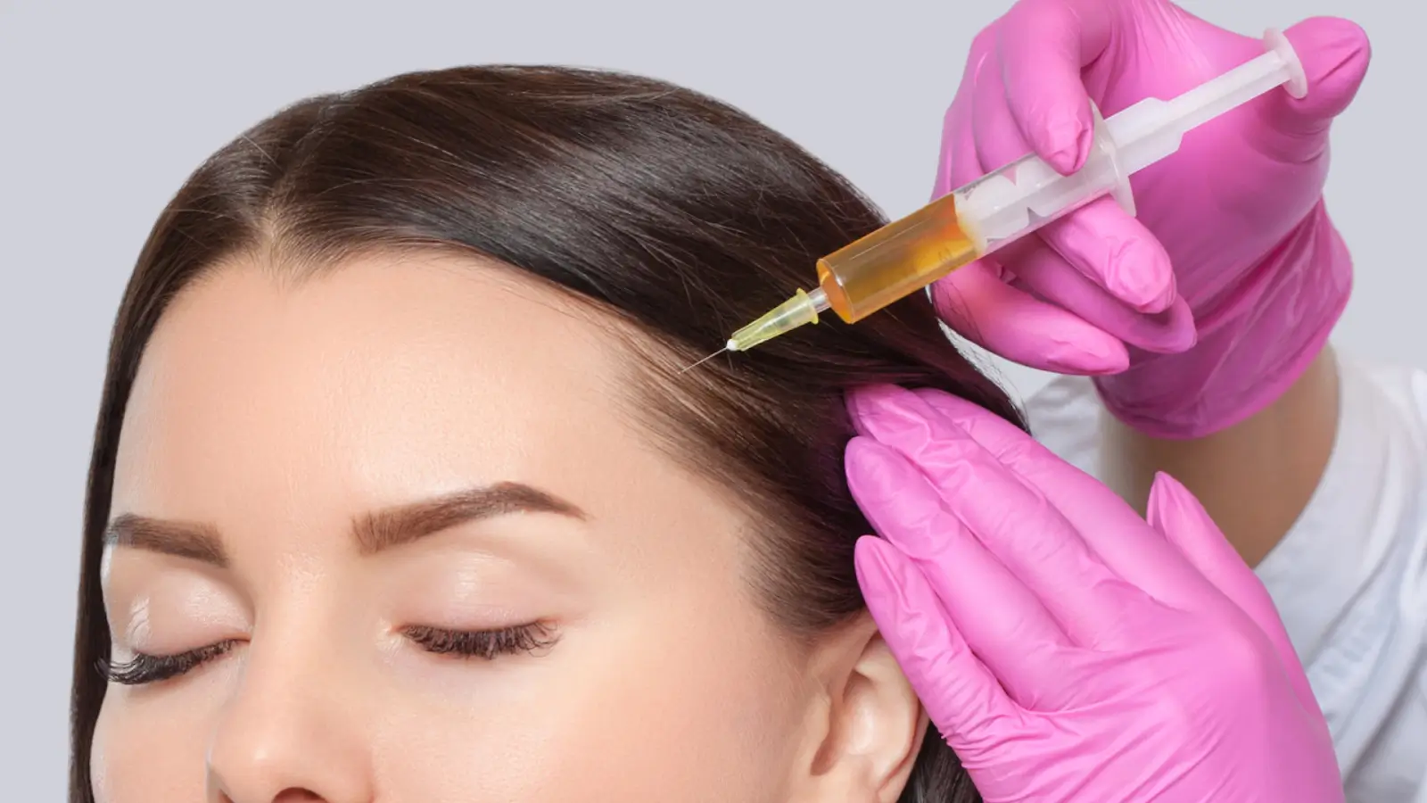 Woman getting hair filler. 