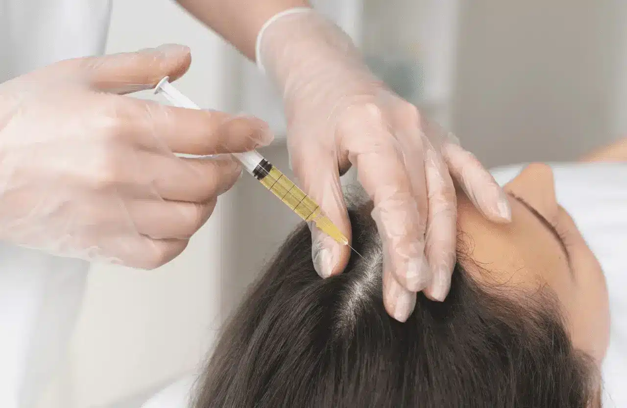 Woman getting hair injection. 