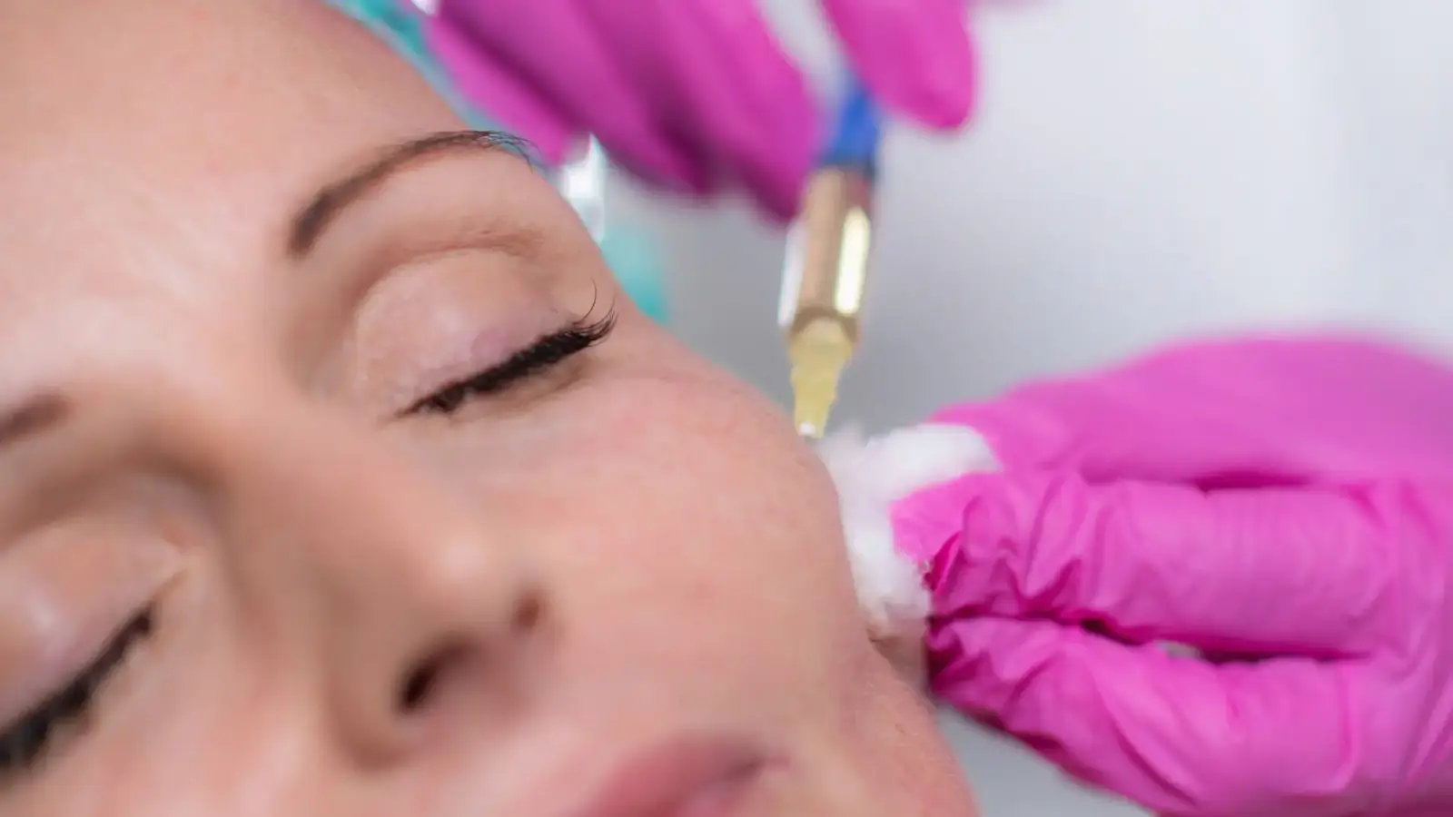 Facial injection.