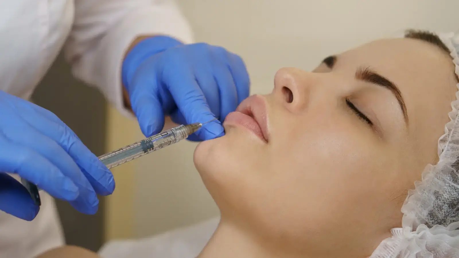 Woman getting lips fiiled. 