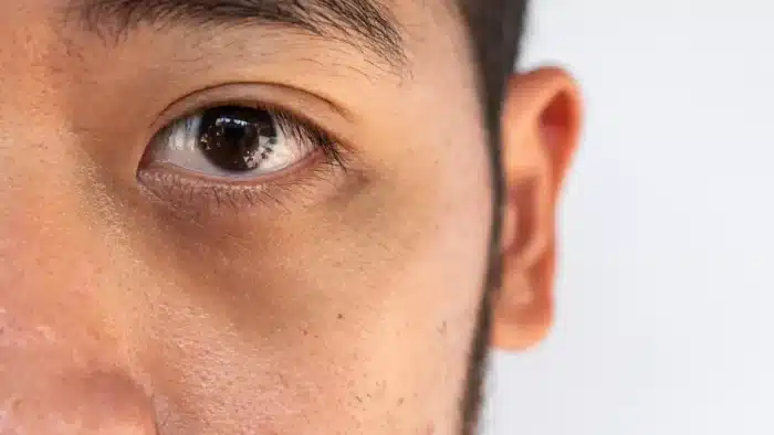 Zoom in of eyes.