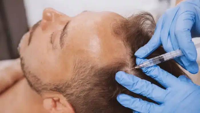 A person with short hair lying down receives an injection to the scalp from gloved hands holding a syringe.