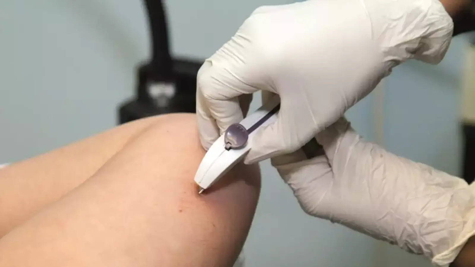 Person getting an implant.