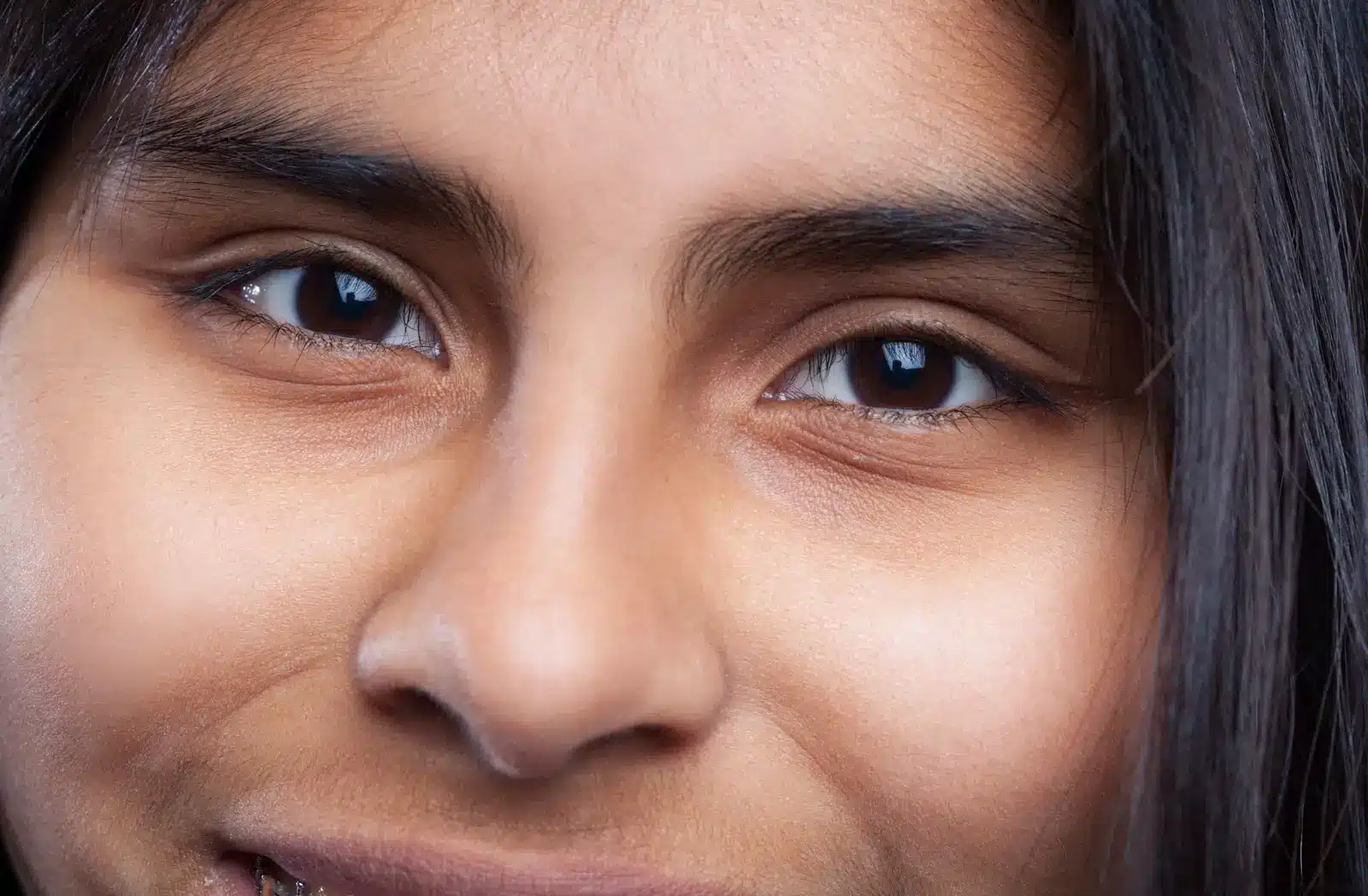 Person with eye bags. 