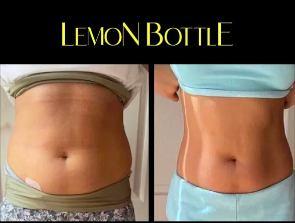 lemon bottle fat dissolving reviews before and after face snatched jawline with lemon bottle fat dissolving