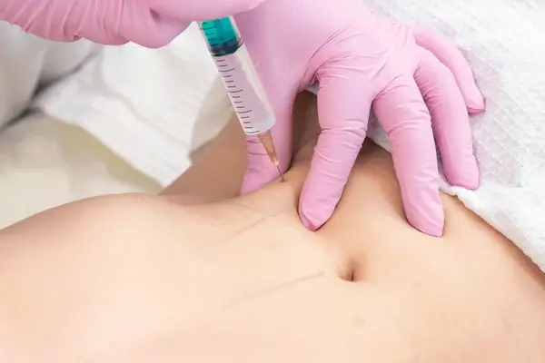 Doctor injecting the stomach. 