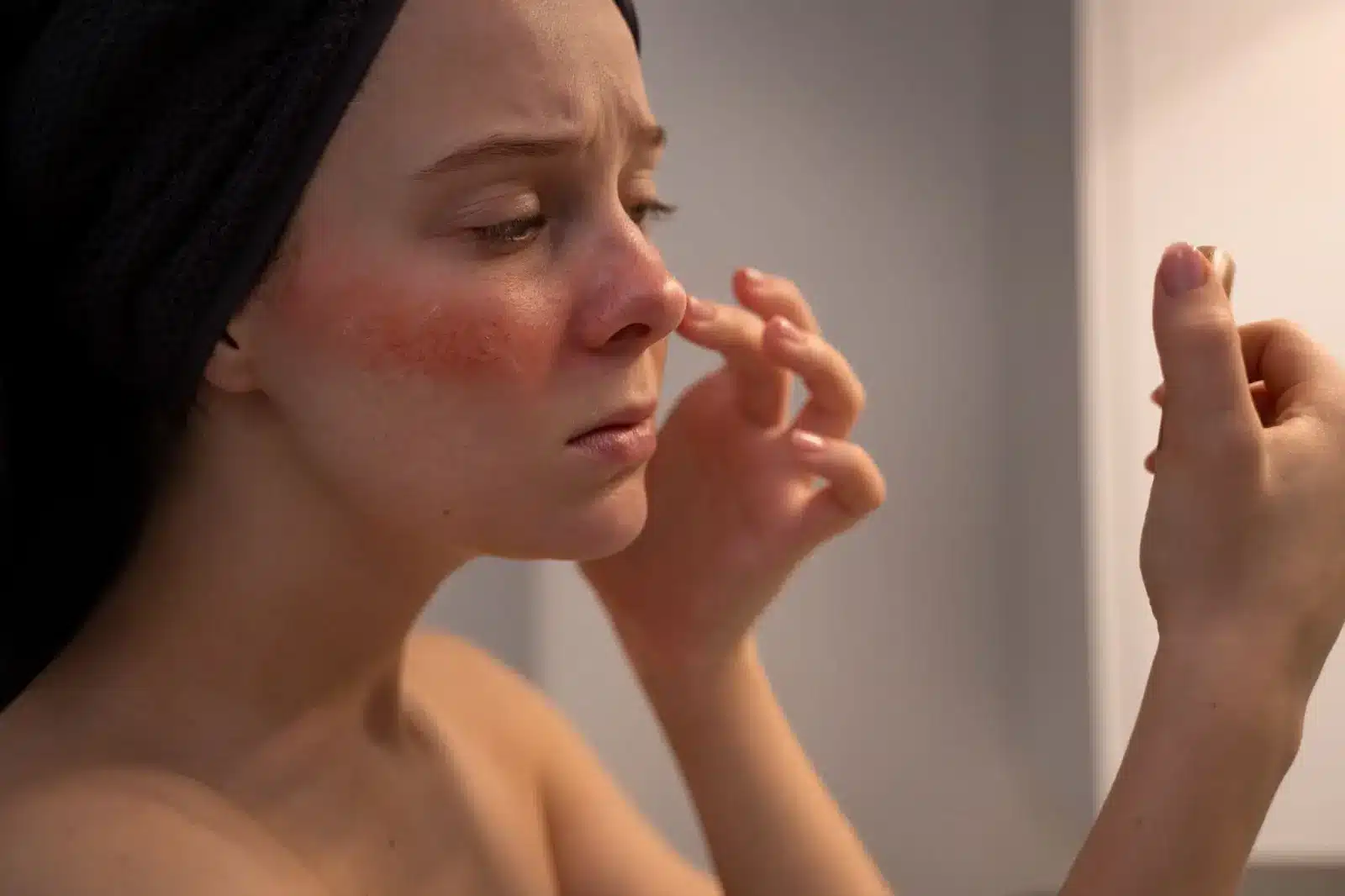 A woman having facial redness after using PRX-T33 treatment.