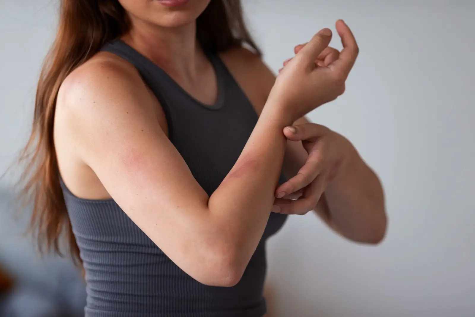 Person experiencing rashes after Entyvio.